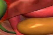 胆囊息肉是一种什么病 胆囊息肉临床有什么症状
