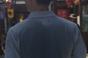 孩子夏天总被蚊子叮叮叮！蚊子喜欢咬什么人 