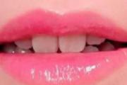 漂唇增生怎么处理