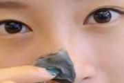 用完黑头贴之后怎么办