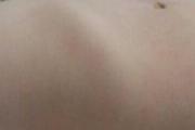 缺钙鸡胸是什么样的
