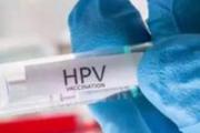 生理期可以打hpv疫苗吗 hpv疫苗生理期之前还是之后打