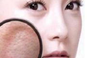 毛孔粗大是什么原因造成的