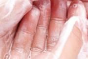 银离子免洗手消毒液安全吗 银离子洗手液和酒精洗手液哪个好