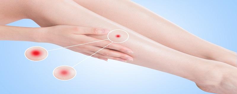 一到晚上睡觉身上痒怎么回事啊 主要是螨虫惹的祸3招即可解决 乐哈健康网