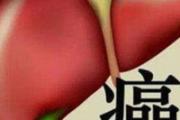 原发性肝癌的首发症状 原发性肝癌的饮食应注意什么