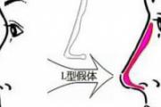 硅胶隆鼻多少钱