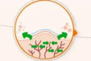 激光割双眼皮效果好吗 激光去双眼皮疤痕有用吗