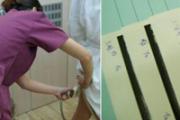 自体脂肪丰胸手术过程