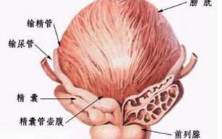 前列腺钙化的原因