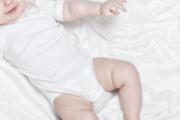 婴儿血管瘤的最佳治疗时间 婴儿血管瘤治疗采取什么方法最好