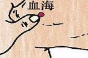 小儿推拿血海的定位 小儿的血海怎么找