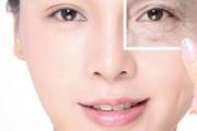 去皱纹有什么好办法 日常怎么去皱纹