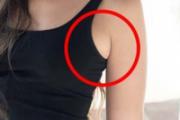 副乳是什么 副乳的危害有哪些