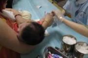 宝宝缺钙需要检查什么