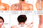 下巴长痘艾灸哪个部位 艾灸治痘只需4步搞定！