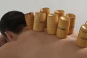 男人拔罐后可以同房吗 男人拔罐要注意以下几个方面