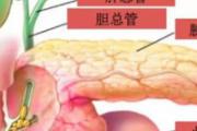 左上腹部疼痛的可能病因