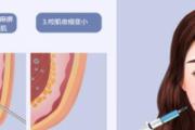 夏天可以打瘦脸针吗 夏天打瘦脸针会不会没效果