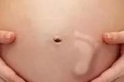 孕妇尿频尿急怎么办 3招帮你摆脱尿频困扰