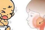 腮腺炎小儿推拿手法 小儿腮腺炎推拿图