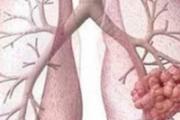 肺结核痊愈后和正常人一样吗 肺结核痊愈后要注意什么