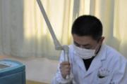 瘊子祛除激光还是冷冻