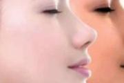 脸上色斑如何去除