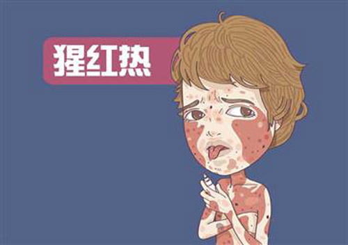 猩红热多久能好