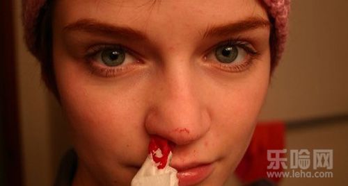 鼻子受伤后经常流鼻血怎么办