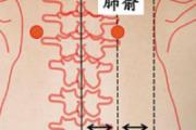 食道炎艾灸治疗方法