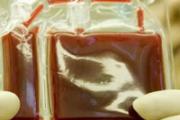 宝宝脐带血怎么保存