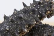 甲状腺结节癌变的表现 这些不同的表现需要牢记！