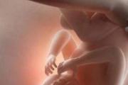 孕检正常宝宝就健康么 孕检正常宝宝畸形的原因是什么