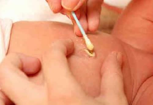 新生儿脐带半个月还没掉怎么回事脐带十几天还不掉怎么办 乐哈健康网 新生儿脐带半个月还没掉怎么回事脐带十几天还不掉怎么办 乐哈健康网