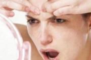 脖子上长痘痘怎么办 5点教你处理