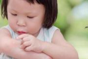 蚊子喜欢咬什么体质的人 蚊子叮咬红肿热痛？中药内用外洗可改善